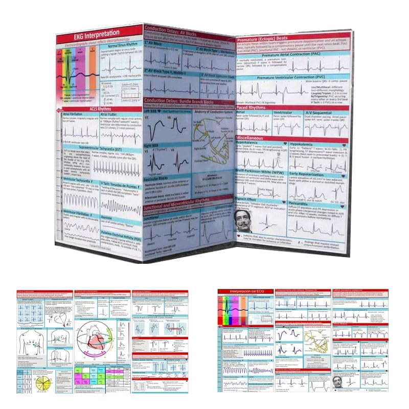 EKG Pocket Guide, EKG Rhythm Interpretation Pocket Reference Guide ...