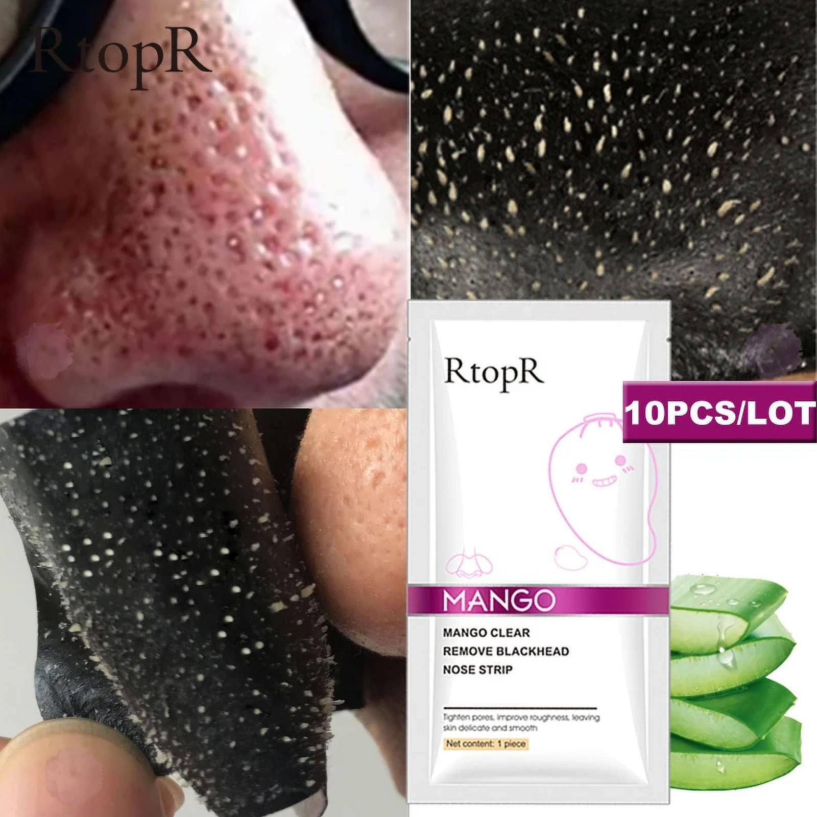 This New Treatment Eradicates Big Blackheads   Fast! - ugy2k24