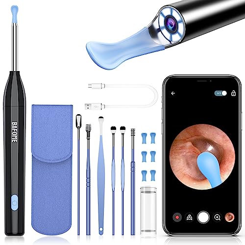 Ear Cleaner with Camera, 1920HD Ear Cleaner, Ear Wax Removal Tool