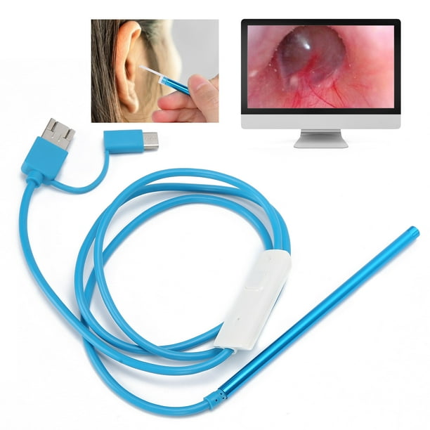 Ear Endoscope 3In1 Visual Earpick Visible Ear Spoon Handle Examination Endoscope Ear Wax