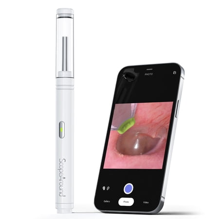 Ear Wax Removal with Camera, ScopeAround WIFI Ear Scope Cleaner Kit Endoscope with Light for iPhone, iPad, Android