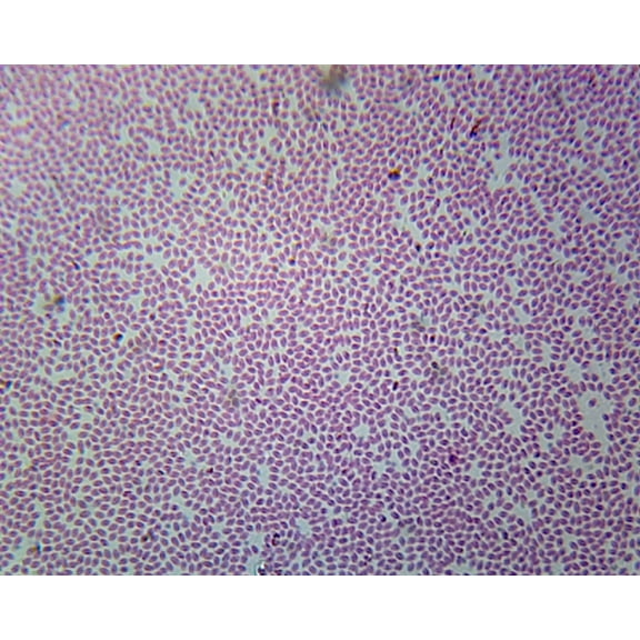 Earthworm Blood; Smear by Go Science Crazy