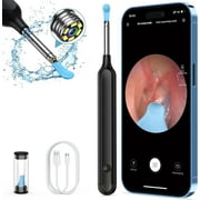 Earwax Camera Otoscope Cleaner, Cordless Ear Wax Removal Kit with Camera, 6 LED Light and 500W HD Endoscope for iPhone & Android Smart Phones, Black