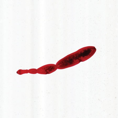 Echinococcus Granulosus Slide, W.M.