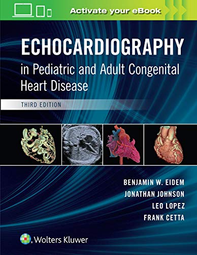 Pre-Owned Echocardiography in Pediatric and Adult Congenital Heart ...