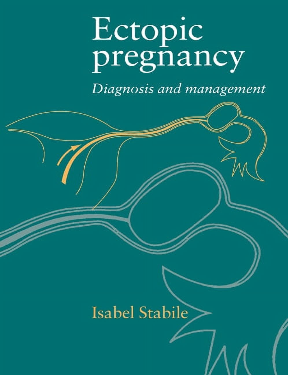 Ectopic Pregnancy: Diagnosis and Management, (Paperback)