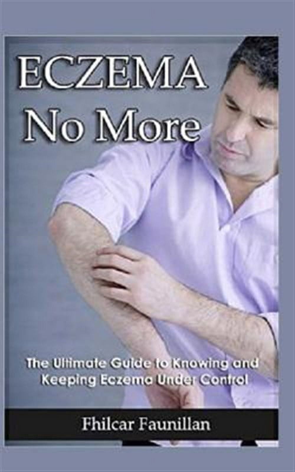 Eczema Cure: Eczema No More - The Ultimate Guide to Knowing and Keeping Eczema Under Control (Paperback)
