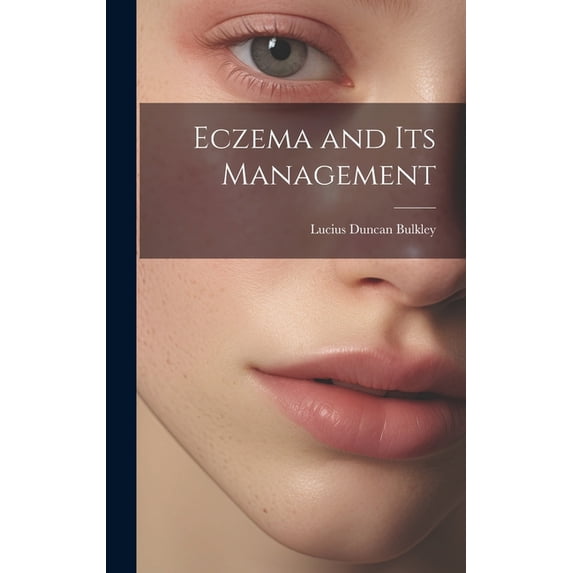 Eczema and Its Management (Hardcover)