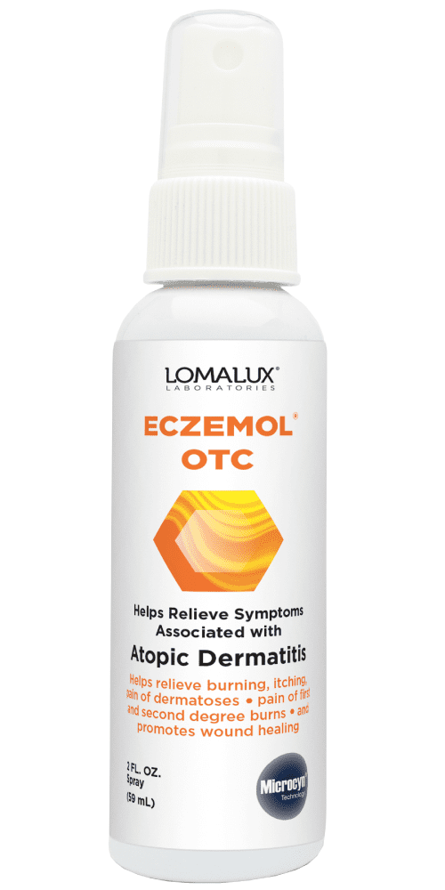 Eczemol OTC 2 fl. oz. Topical Spray FDA Cleared Skin Healing Treatment For Eczema, First