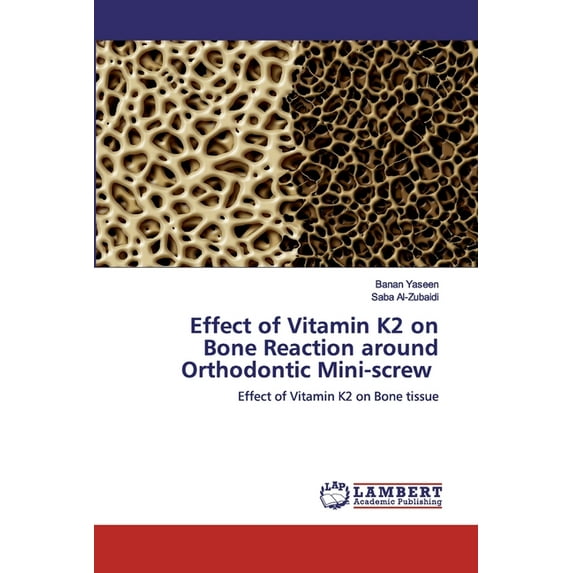 Effect of Vitamin K2 on Bone Reaction around Orthodontic Mini-screw (Paperback)