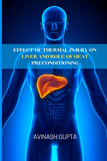Effect of thermal injury on liver and role of heat preconditioning ...