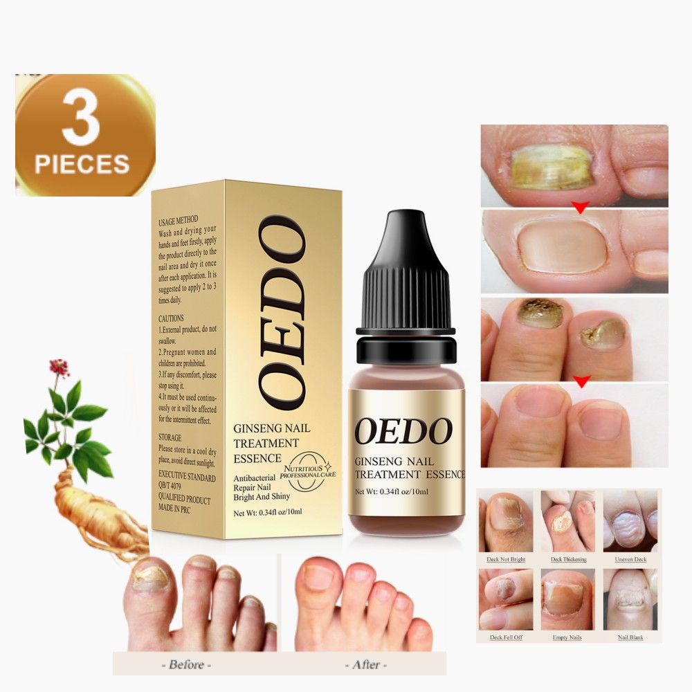 Effective Fungus Removal Nail Treatment Essence Oil Moisturizing Care
