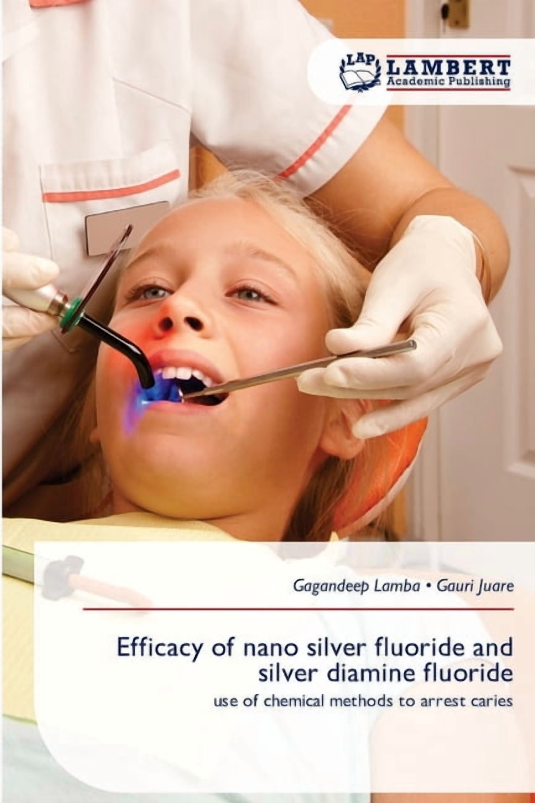 Efficacy of nano silver fluoride and silver diamine fluoride, (Paperback)