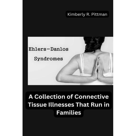 Ehlers-Danlos Syndrome: A Collection of Connective Tissue Illnesses That Run in Families