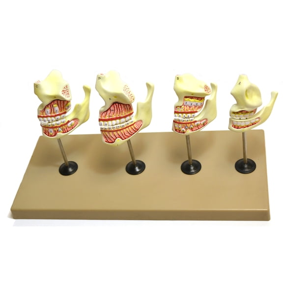 Eisco Labs Dentition Model - 4 Stages; 8 Pieces