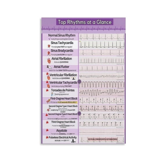Ekg And Ecg Rhythms Poster Medical Student Poster Canvas Wall Art Poster For Room Aesthetic And Decor Poster For Bedroom Bathroom Living Room Office Kitchen Decor