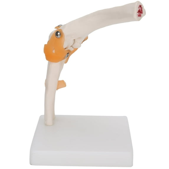 Elbow Joint Model Life Size Accurate Elbow Skeleton Model Resin + Pvc 7.5 X 4.7 X 4.7In Contains Part Of Humerus Placed On The Base Frame Detachable For Study Display Teaching