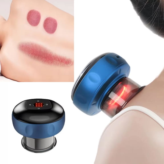 Electric Cupping Massager Kit 12-Level Temperature & Suction Control for Muscle Relaxation