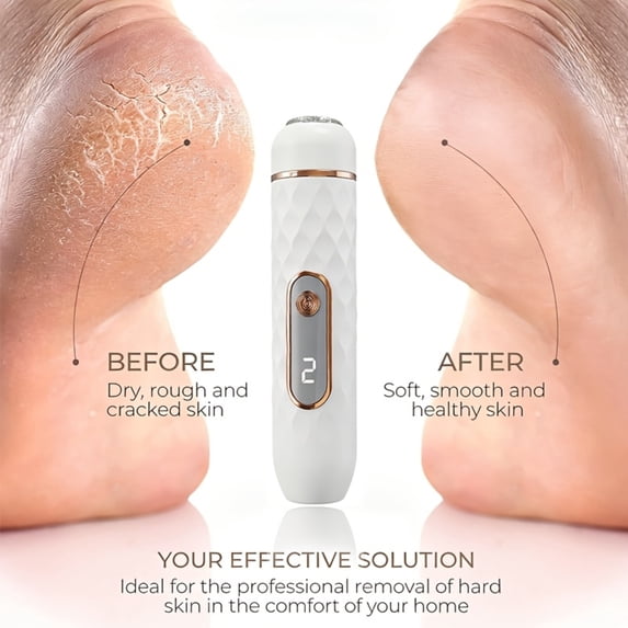 Electric Foot Grinder Rechargeable, Electric Callus Remover for Feet, Foot File for Dry Cracked Heels, Portable Pedicure Tool for Smooth Feet at Home, Self Care Valentines Day Gifts, 1Pcs White
