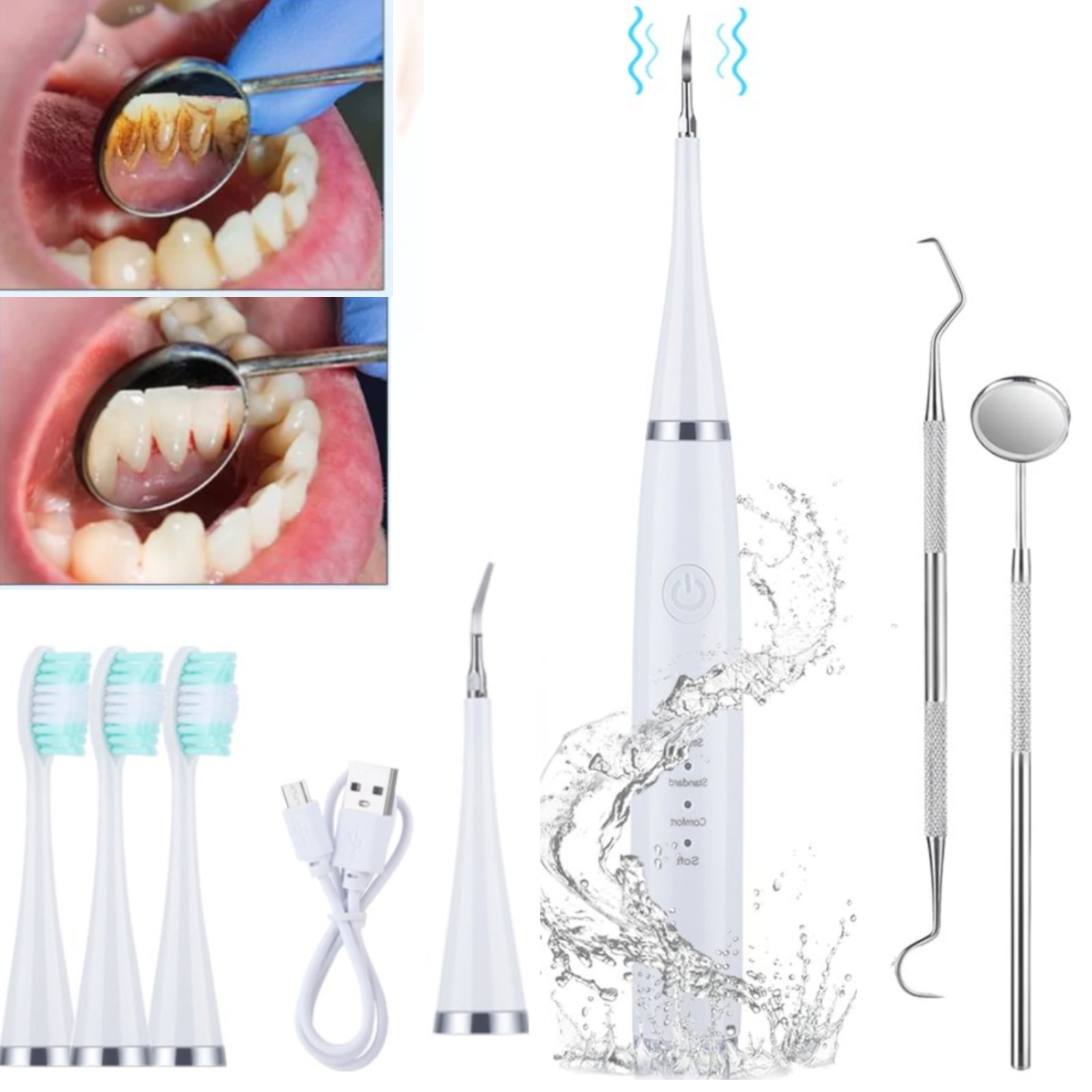 Electric Teeth Cleaning Kit , IPX7 Waterproof Ultrasonic Teeth Cleaner
