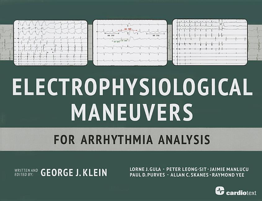 健康・医学 Electrophysiological Maneuvers Electrophysiological Maneuvers for Arrhythmia Analysis