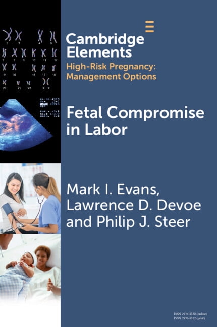 Elements in High Risk Pregnancy: Managem Fetal Compromise in Labor, (Paperback)