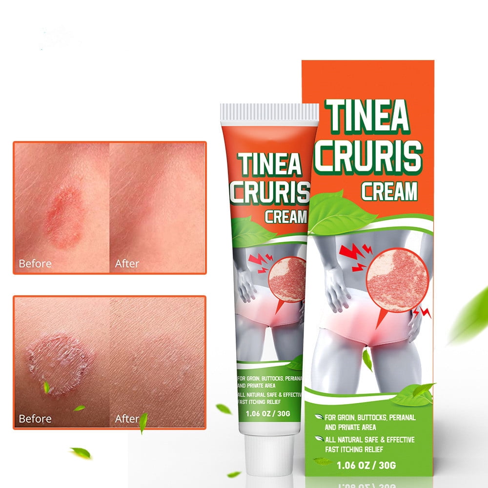 Eles Stock Dermatitis Cream For Groin, Pilonidal, Anal Skin Rash