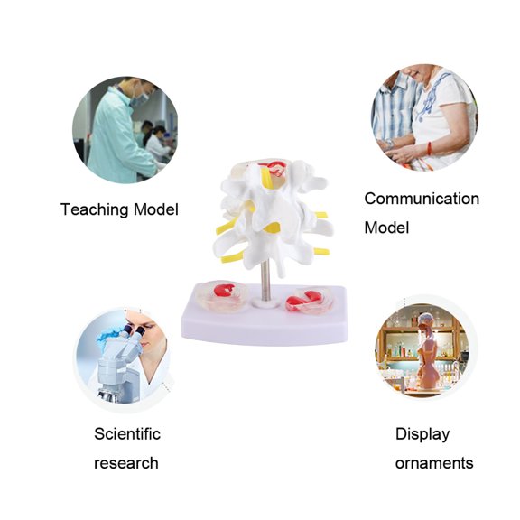 Elowen Human Spine Model Lumbar Model, Human Spine Model Mounted Securely with 2 Diseased Intervertebral Discs for School