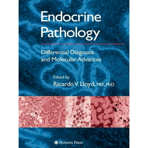 Endocrine Pathology: Differential Diagnosis and Molecular Advances, (Paperback)