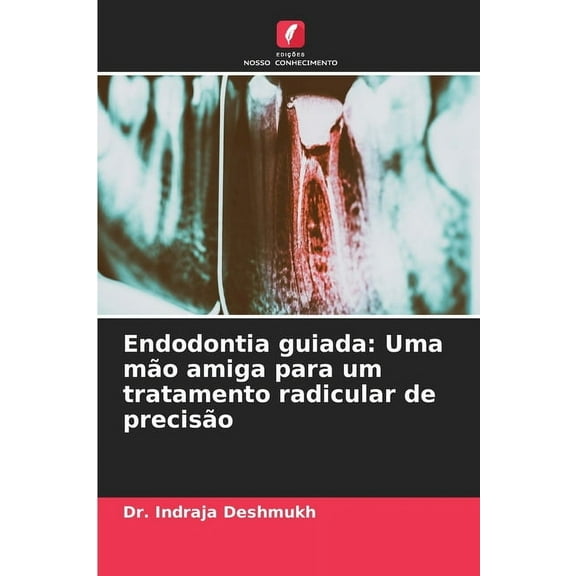 Endodontia guiada: Uma mo amiga para um tratamento radicular de preciso, (Paperback)