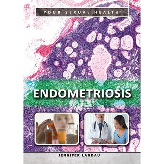 Pre-Owned Endometriosis 9781499460766 /