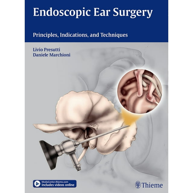 Endoscopic Ear Surgery Principles, Indications, and Techniques