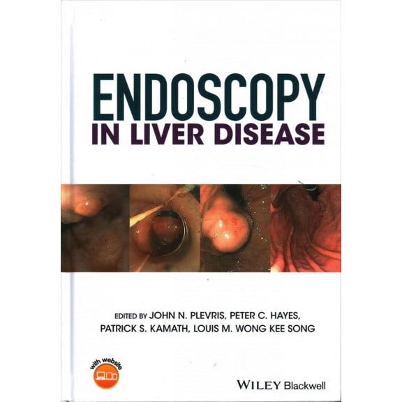 Endoscopy in Liver Disease (Hardcover)
