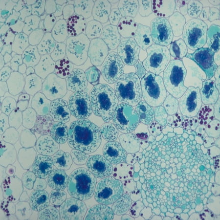 Endotrophic Mycorrhiza, C.S., 12 M Microscope Slide