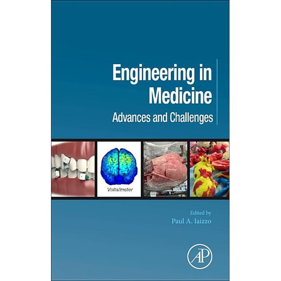 Engineering in Medicine: Advances and Challenges, (Hardcover)
