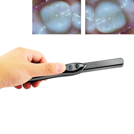 Enhance Dentistry with Dental Intraoral Camera - High-Resolution 6MP, 6-LEDs, USB 2.0