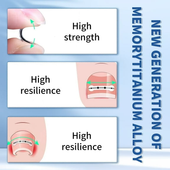 Enhanced Titanium Nail Implant Corrector - Ultimate Ingrown Toenail Treatment & Pain Relief