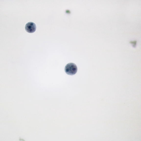 Entamoeba Histolytica Cysts, Smear Microscope Slide