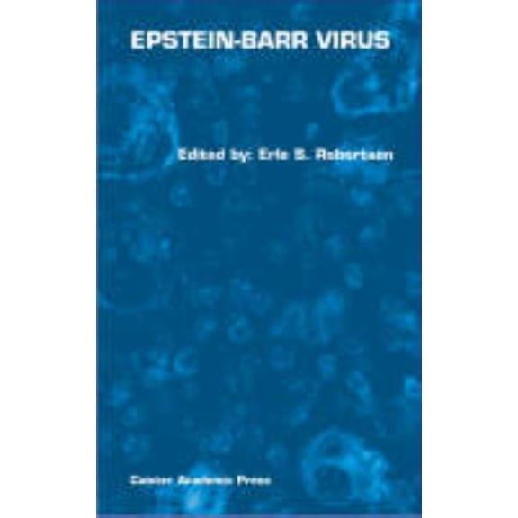 Epstein-Barr Virus, (Hardcover)