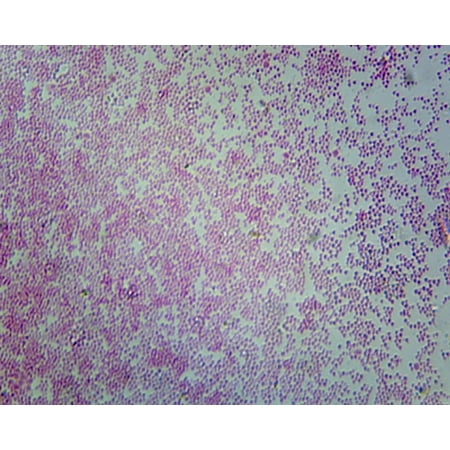 Escherichia Coli; Smear; Gram-Negative by Go Science Crazy