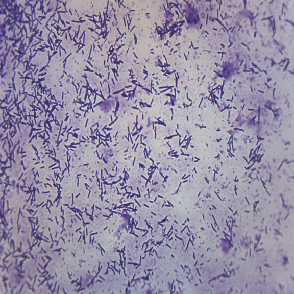 Escherichia Coli Smear, Gram Stain - Prepared Microscope Slide - 75 x 25mm - Biology & Microscopy - Eisco Labs