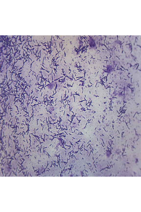 Escherichia Coli Smear, Gram Stain - Prepared Microscope Slide - 75 x 25mm - Biology & Microscopy - Eisco Labs