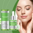 thumbnail image 1 of Essence 30ml 10+hyaluronic Redness Soothing Redness Facial Fade Marks Suitable For Sensitive And All Types, 1 of 7