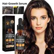 Essence Oil for Hair Growth Skin Care Organic Oils Natural Oil for Hair Loss Stimulates Hair Growth Scalp Massager Aromatherapy 30ml, 1pcs
