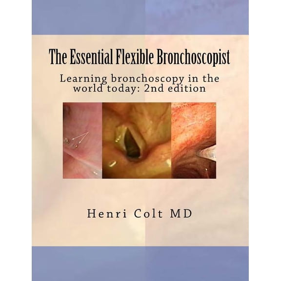 The Essential Flexible Bronchoscopist: Learning bronchoscopy in the world today (Paperback) by Henri Colt