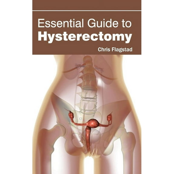 Essential Guide to Hysterectomy, (Hardcover)