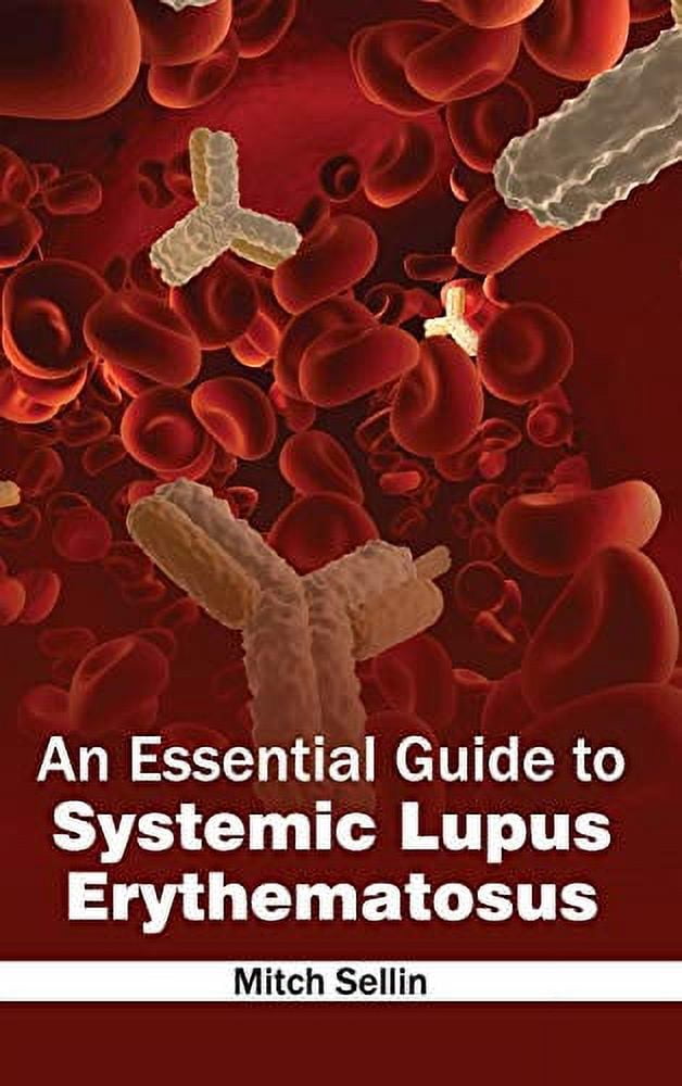 Essential Guide to Systemic Lupus Erythematosus (Hardcover) - Walmart.com