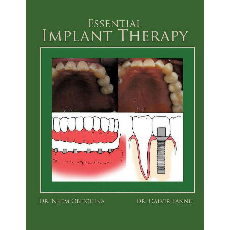 健康・医学 Implant Dentistry: Theory and Practice Principles and Practice of Implant Dentistry: 9780323007672