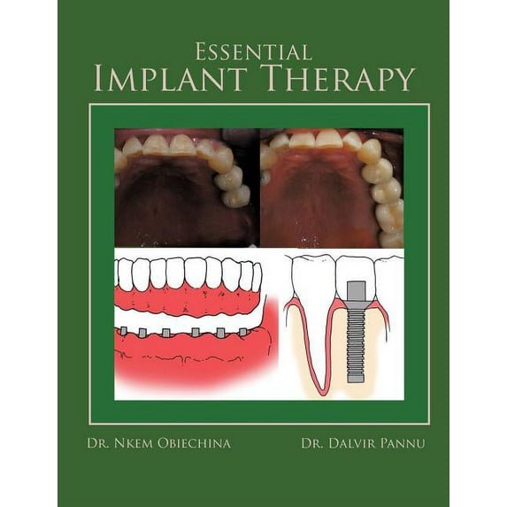 Essential Implant Therapy: A Patient's Guide to Understanding Implant Dentistry, (Paperback)