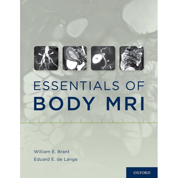 Essentials of Body MRI, (Hardcover)